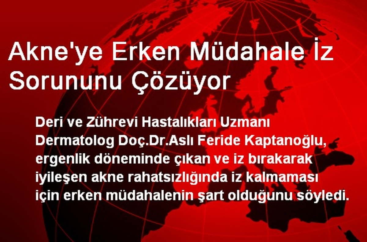 Akne\'ye Erken Müdahale İz Sorununu Çözüyor
