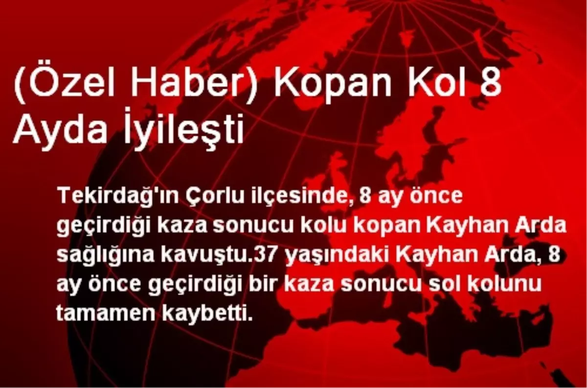 (Özel Haber) Kopan Kol 8 Ayda İyileşti