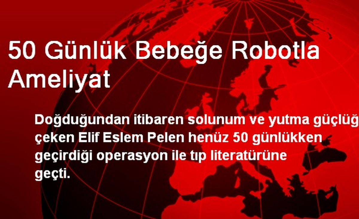50 Günlük Bebeğe Robotla Ameliyat Yapıldı