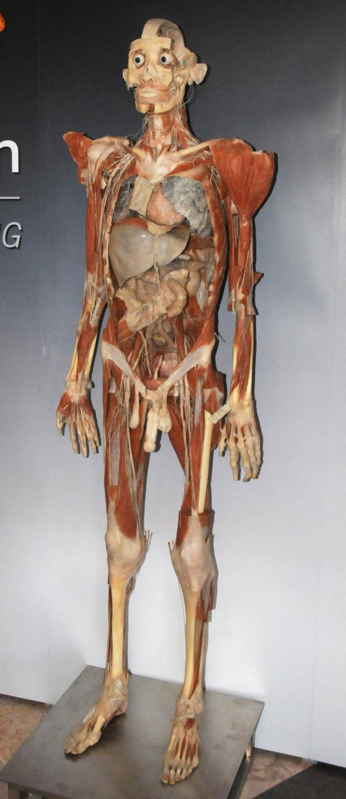 Plastine Edilmiş Kadavra Herkesi Şaşırttı