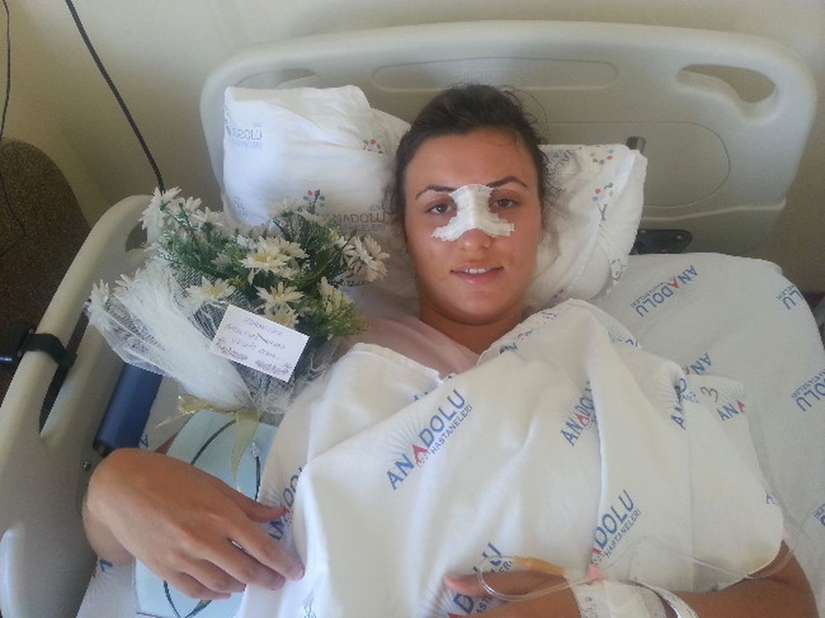 Özge Turmuş\'un Burnu Kırıldı