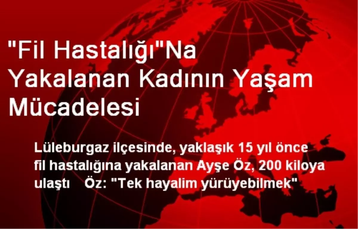 "Fil Hastalığı"Na Yakalanan Kadının Yaşam Mücadelesi