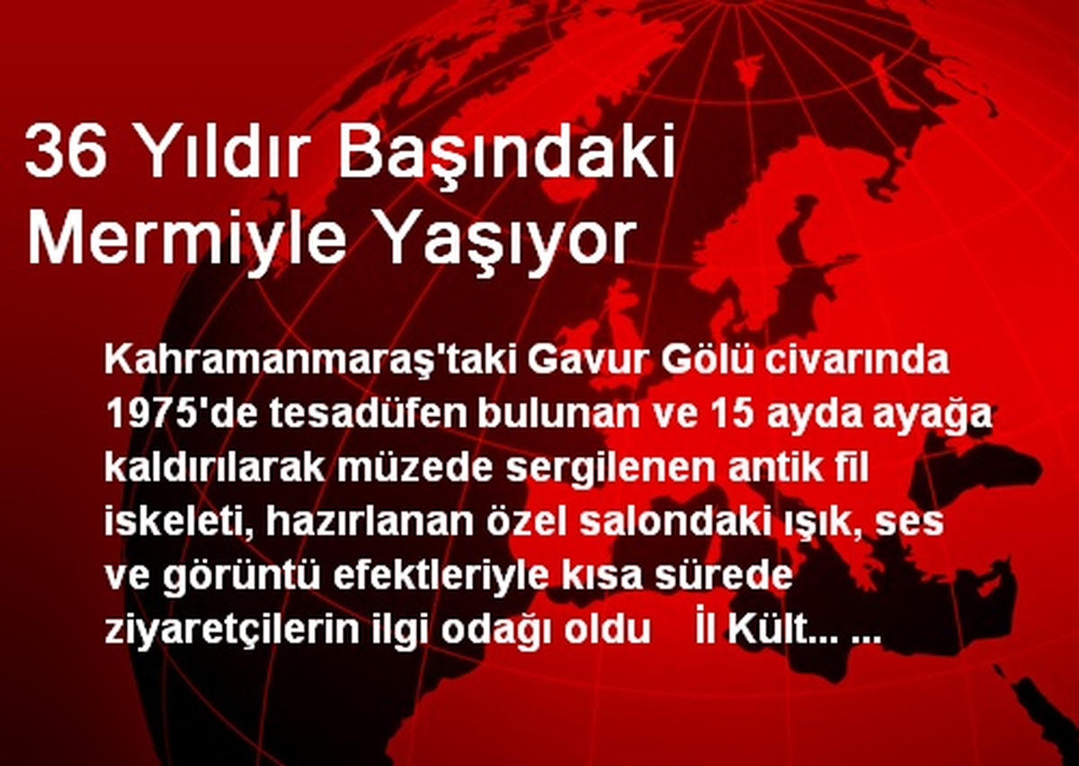36 Yıldır Başındaki Mermiyle Yaşıyor