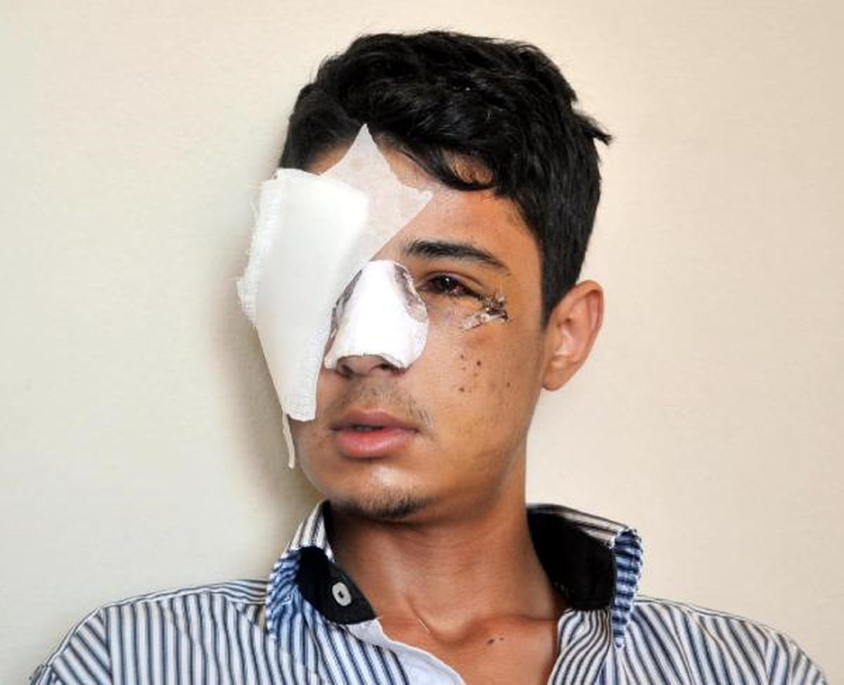 Kör Eden Polise 16 Ay Kıdem Durdurma Cezası