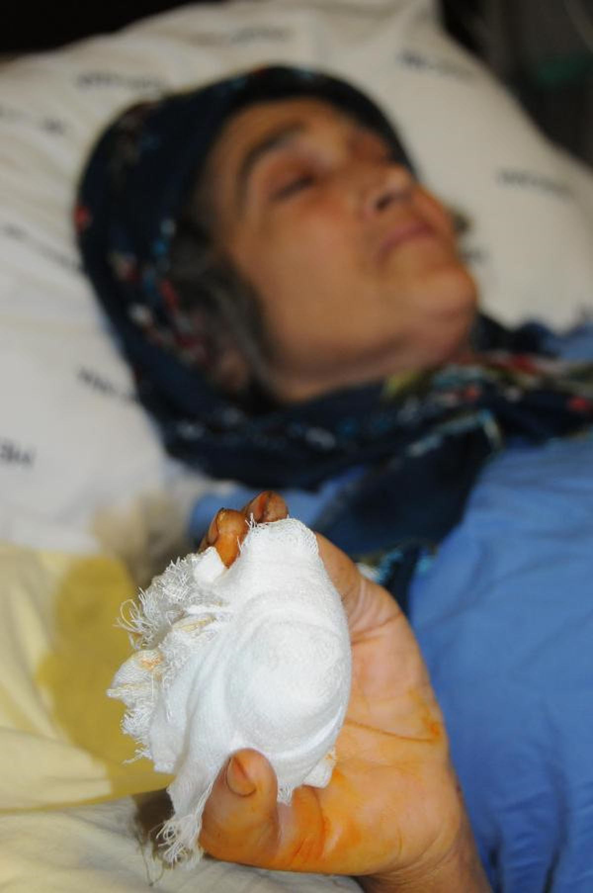 Parmağı Kesilen Kadından Doktora İhmal Suçlaması