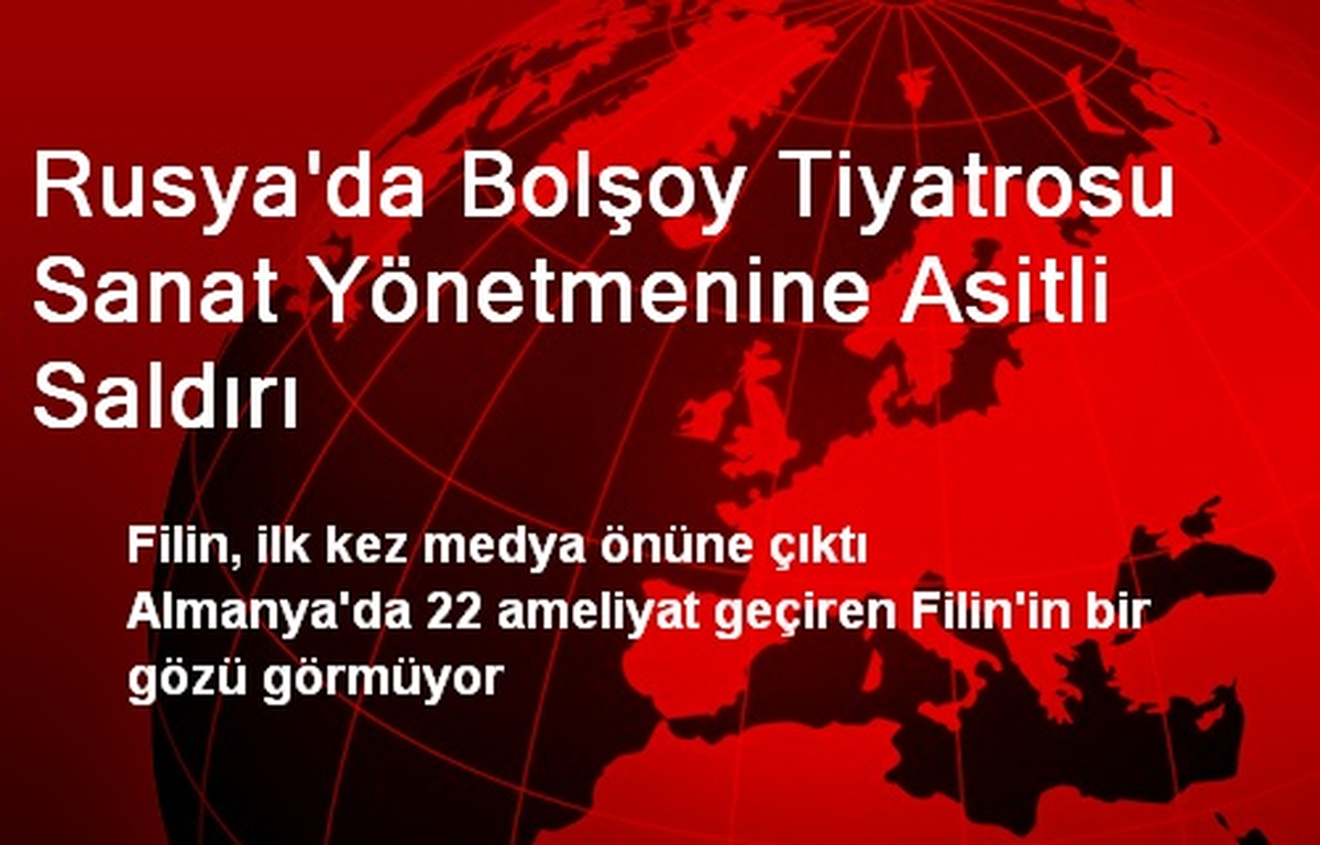 Rusya\'da Bolşoy Tiyatrosu Sanat Yönetmenine Asitli Saldırı