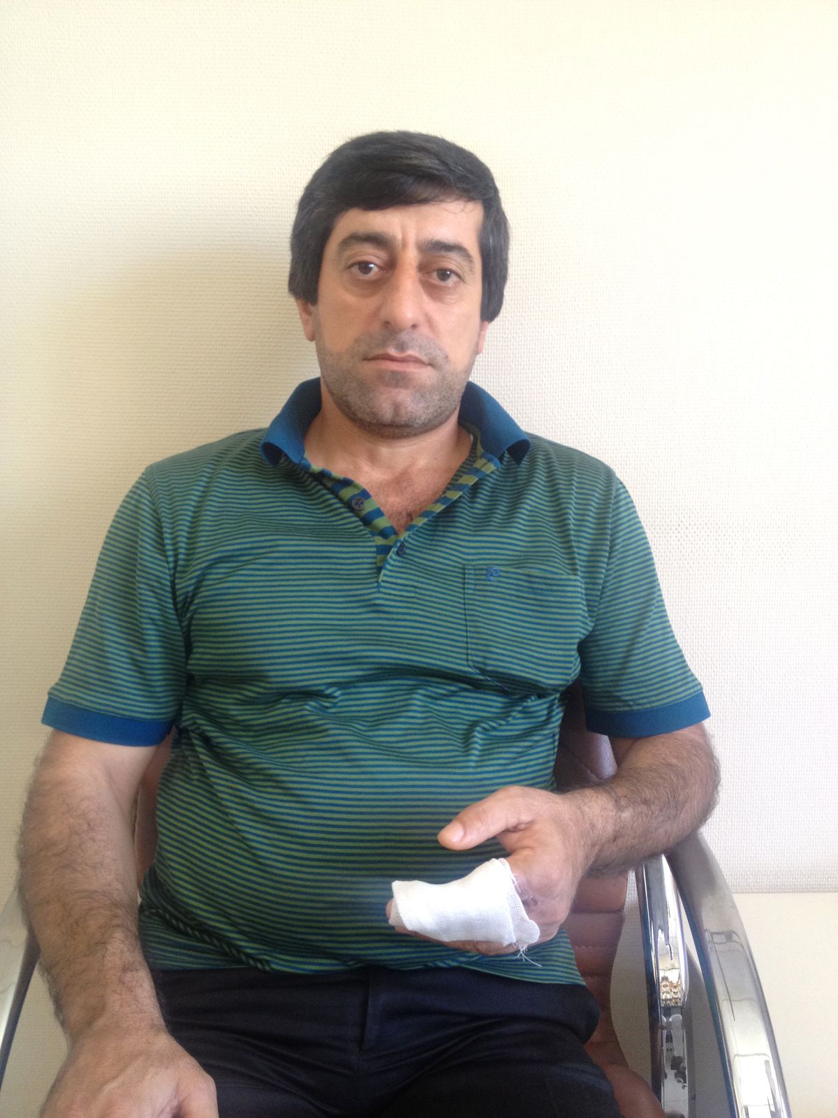 Parmağı Kesilmekten Kurtuldu