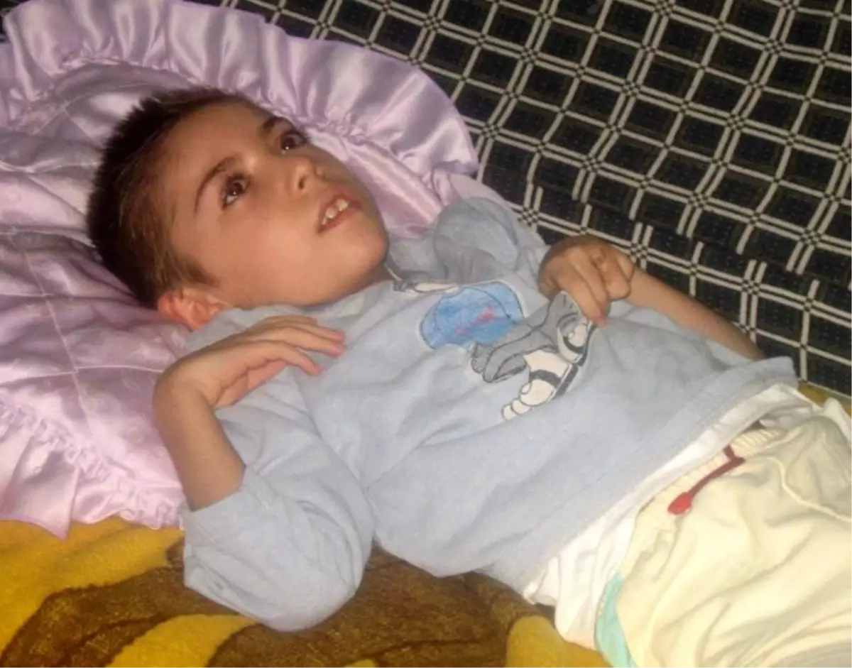 Çocuklarda Sspe Hastalığı