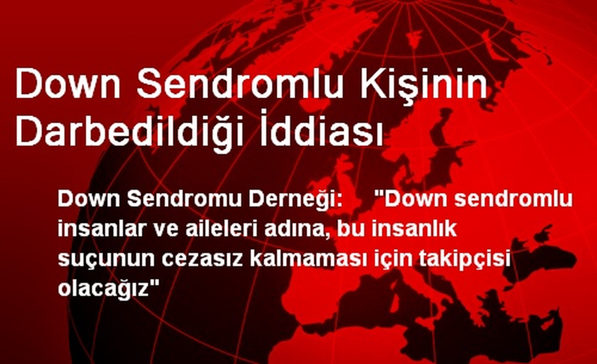 Down Sendromlu Kişinin Darbedildiği İddiası