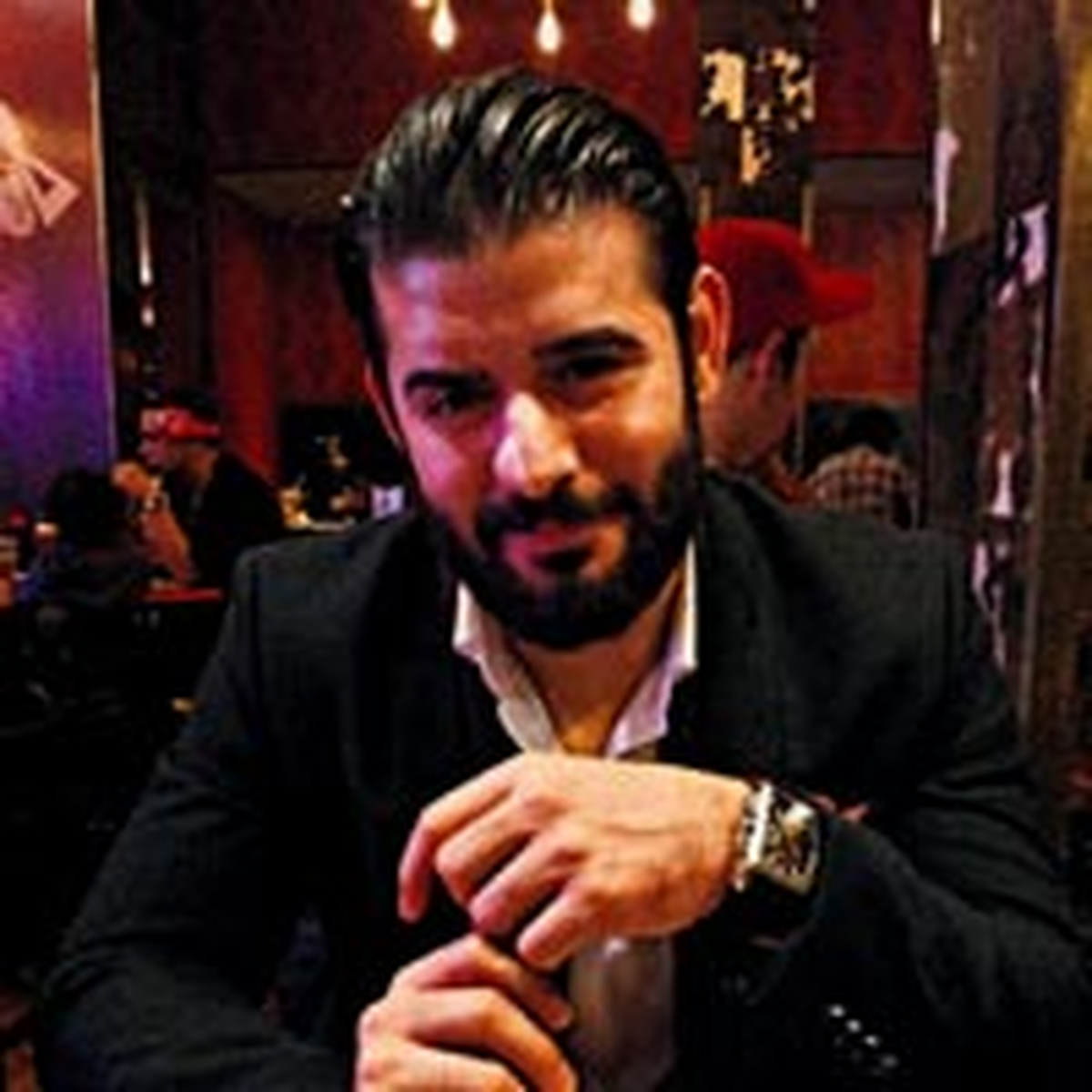 Kopan Burun Yerine Alından Burun Yaptılar