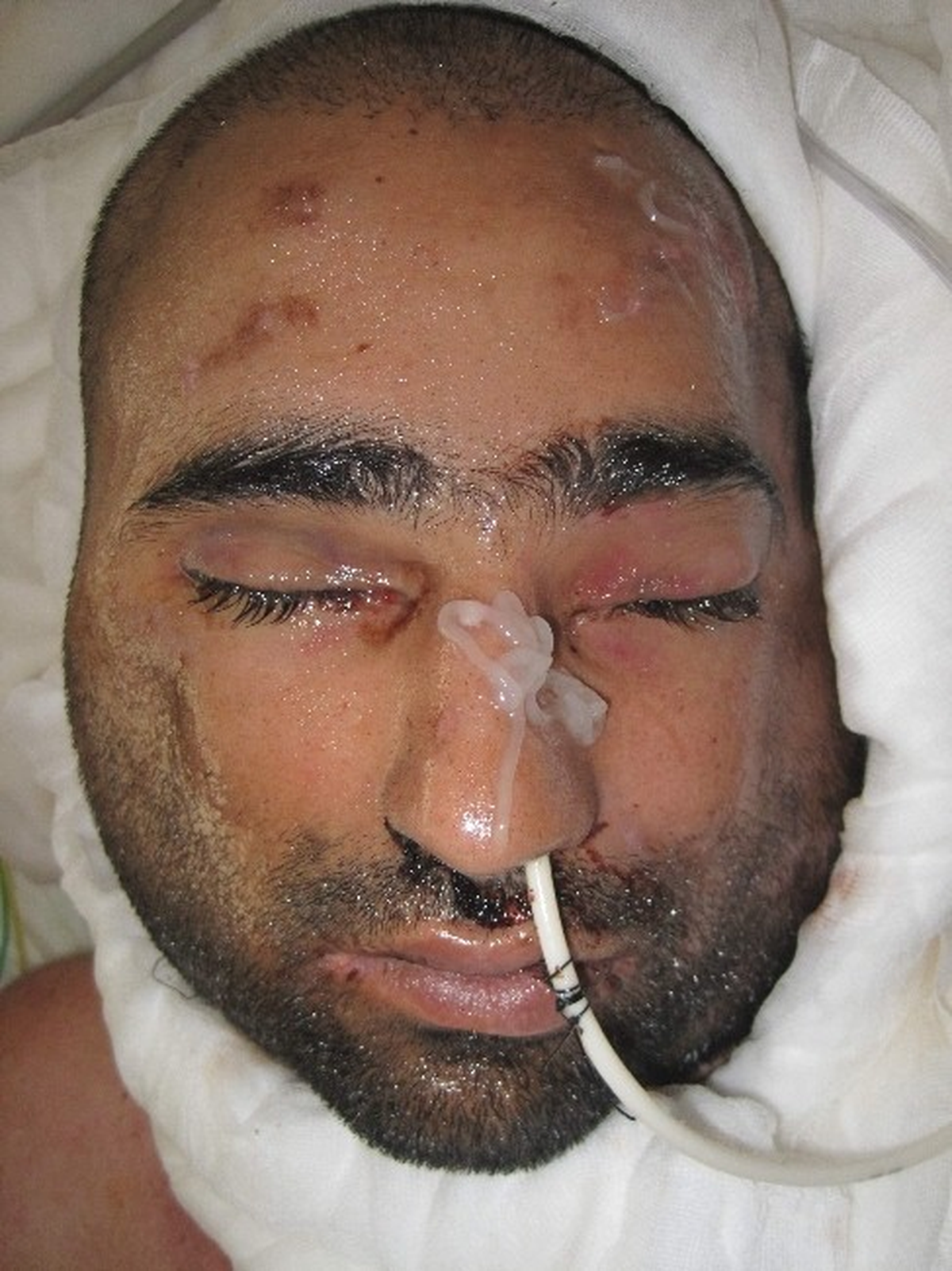 Salih Üslün\'ün Son Hali