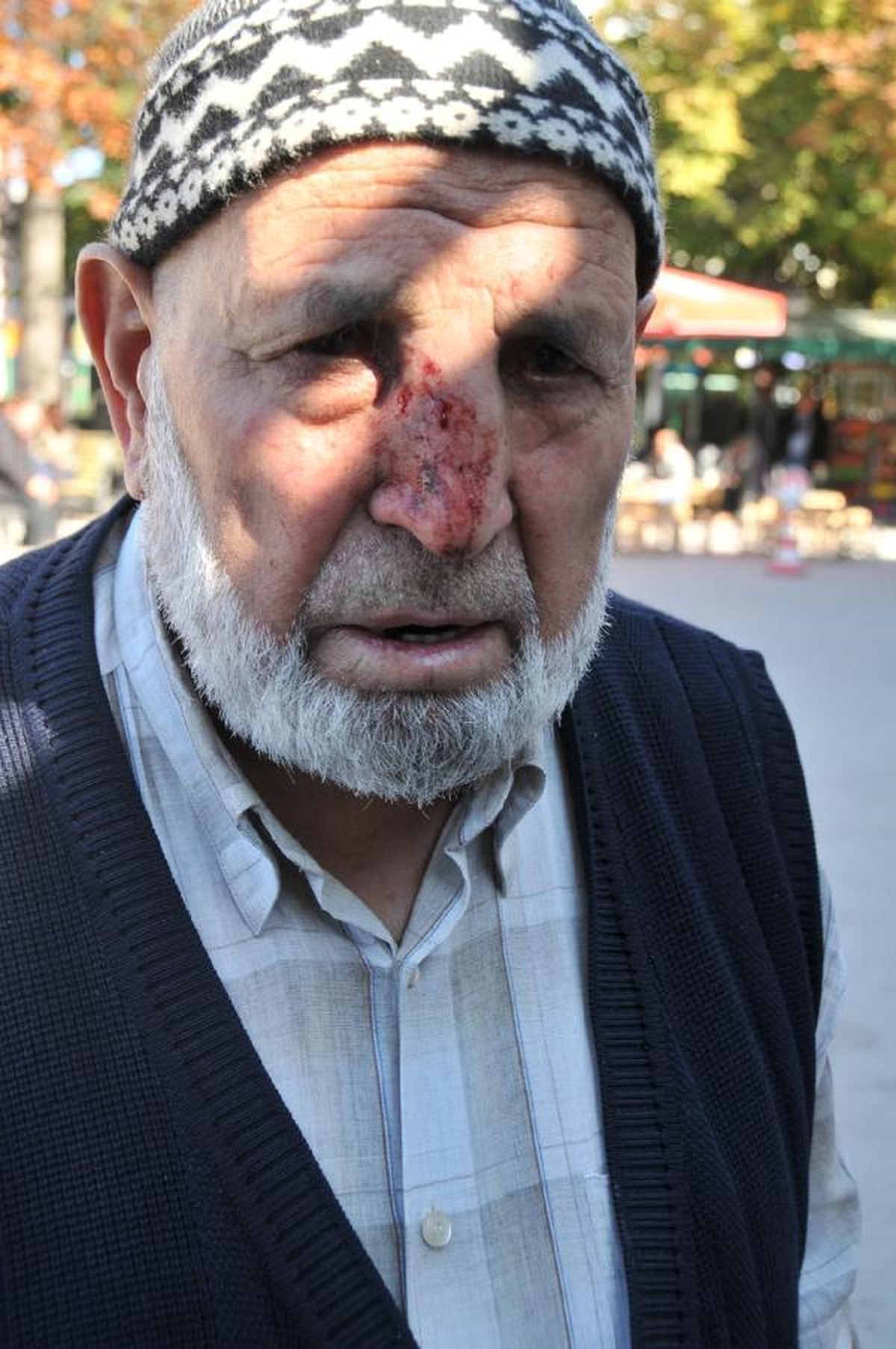 Koçun Boynuzuyla Hastanelik Oldu