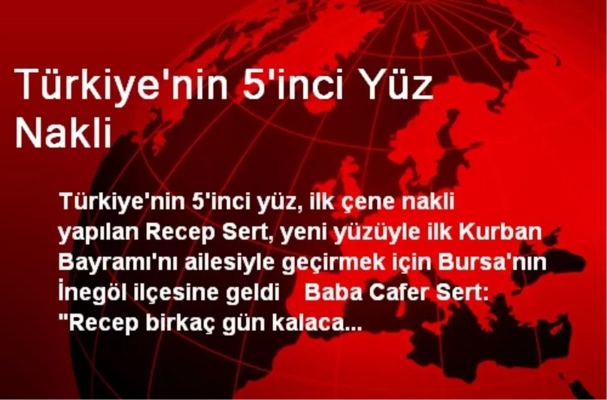 Türkiye\'nin 5\'inci Yüz Nakli