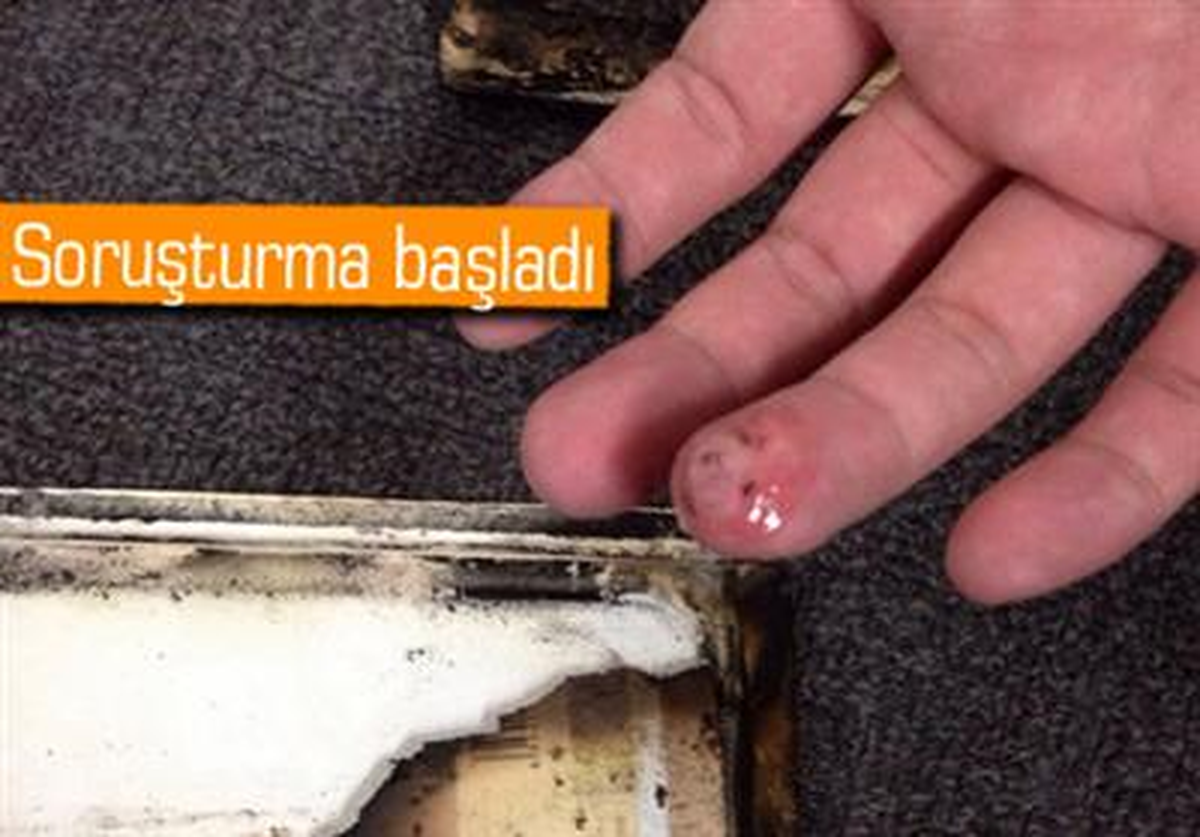 Şimdi de Xiaomi\'nin Telefonu Patladı, Kullanıcı Yaralandı