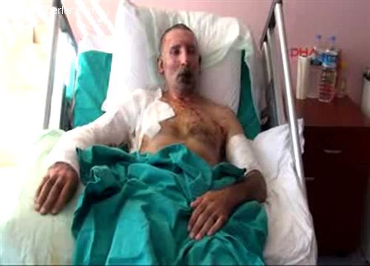 Zift Isıtma Ocağı Patlayınca Yaralandı