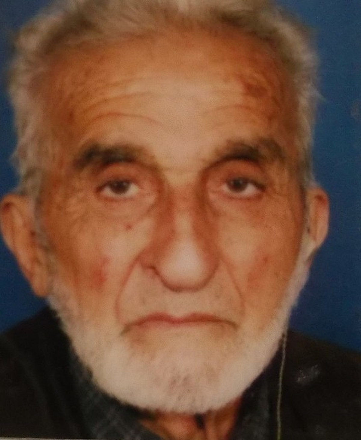 Merdivenden Düşen Yaşlı Adam Kurtarılamadı