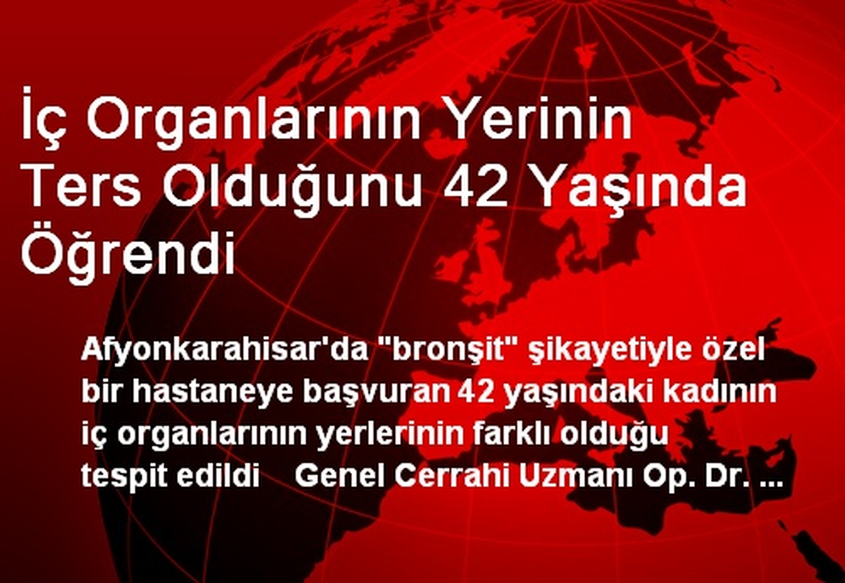 İç Organlarının Yerinin Ters Olduğunu 42 Yaşında Öğrendi