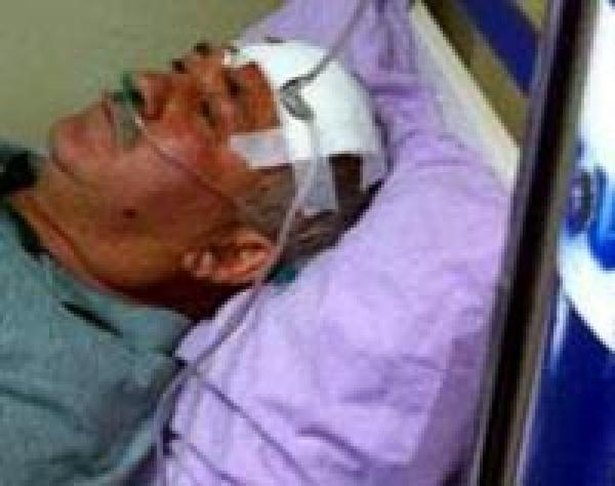 Kınık Belde Başkanı Trafik Kazasında Yaralandı