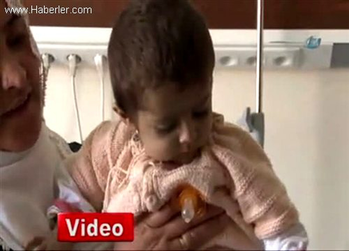 Erzurum\'da Karaciğer Nakli Yapılan Fırat Bebek Sağlığına Kavuştu