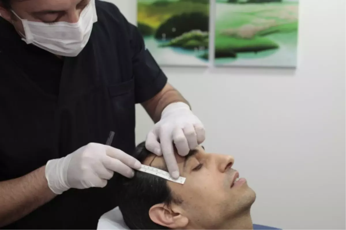 İki Günde Saçlarınıza Kavuşabilirsiniz