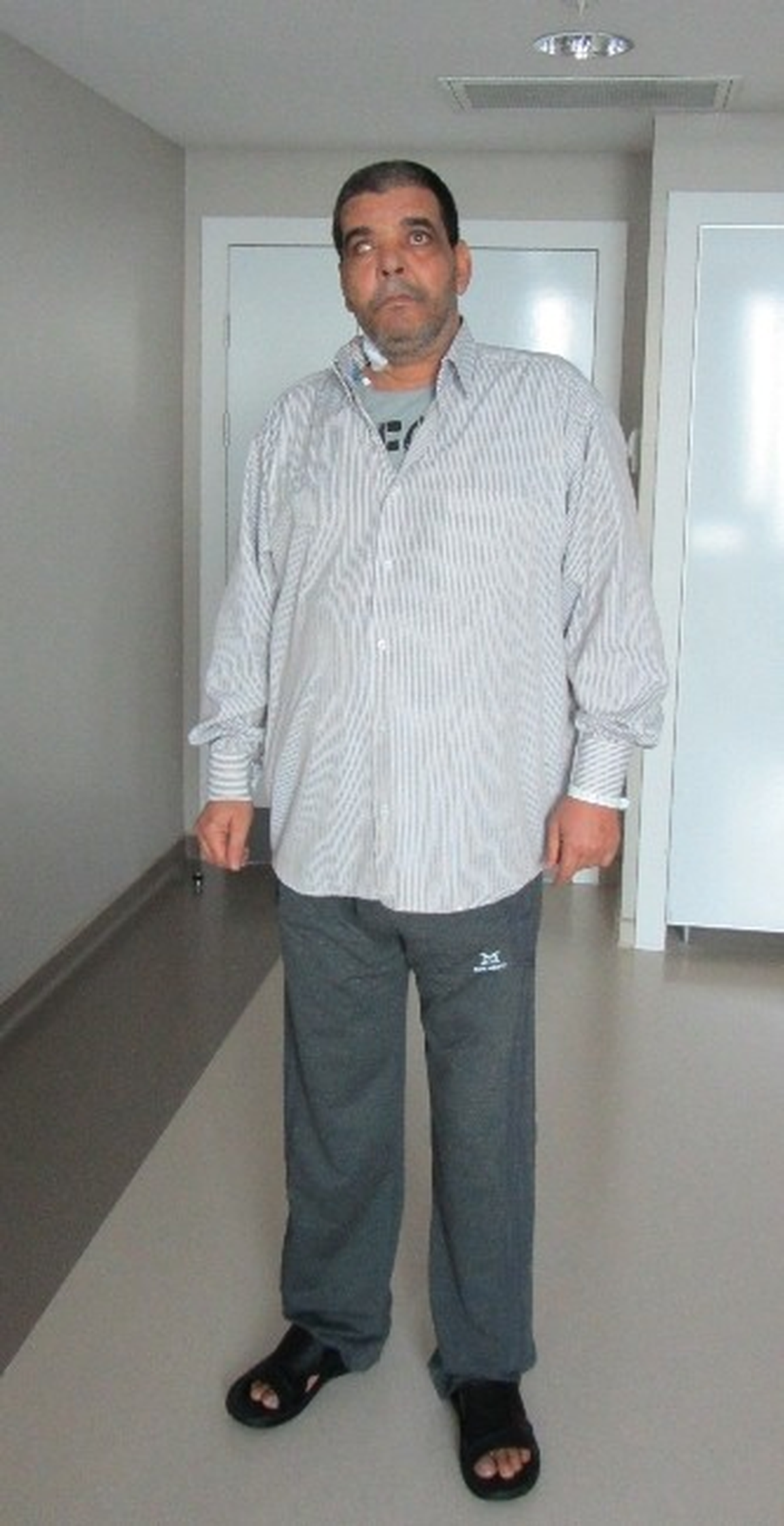 Türk Doktor, Libyalı Hastanın Her İki Bacağını da Kurtardı