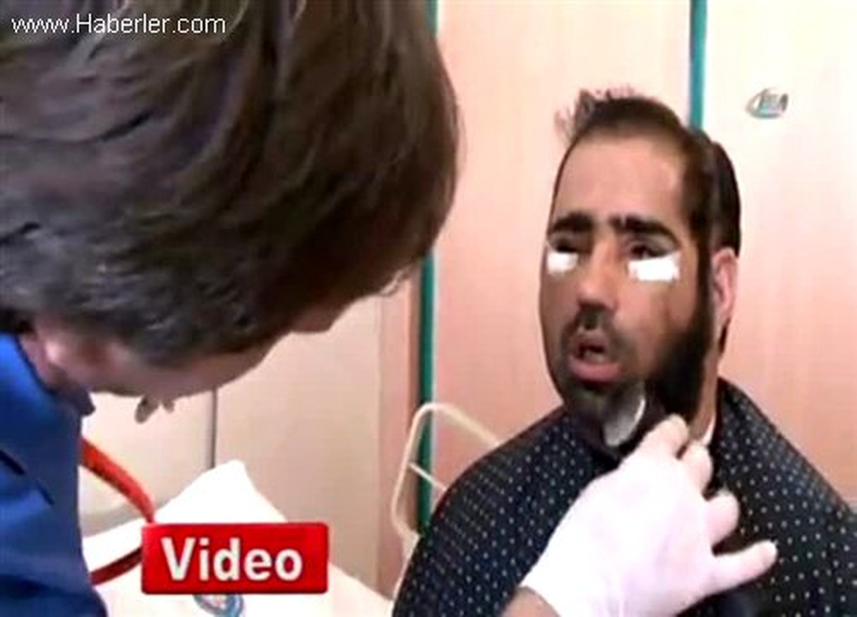 Salih Üslün\'ün Yüz Naklinden Sonraki İlk Fotoğrafları