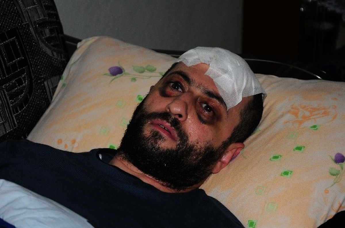 Suriyeli İşçinin Öldüresiye Dövdüğü İşveren, Yaşanan Dehşeti Anlattı