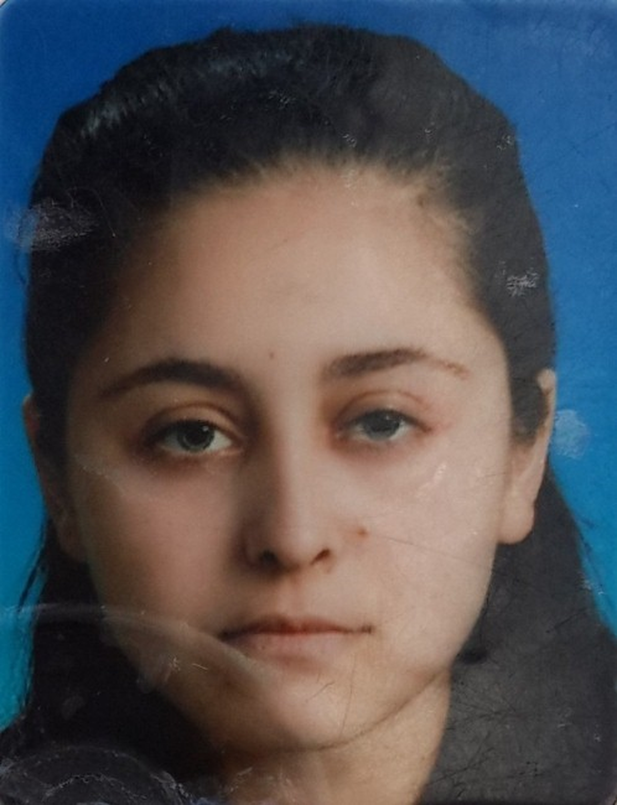 20 Senedir Mücadele Ettiği Kansere Yenildi