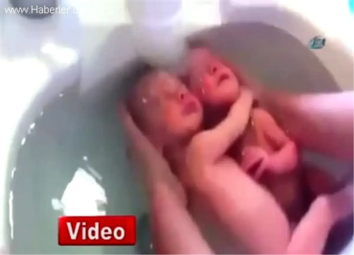 İkizler Kendilerini Hâlâ Anne Karnında Sanıyorlar