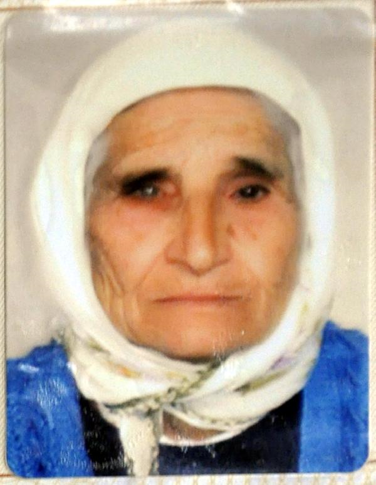 Ateşe Yakarken Eteği Tutuşan Kadın Öldü
