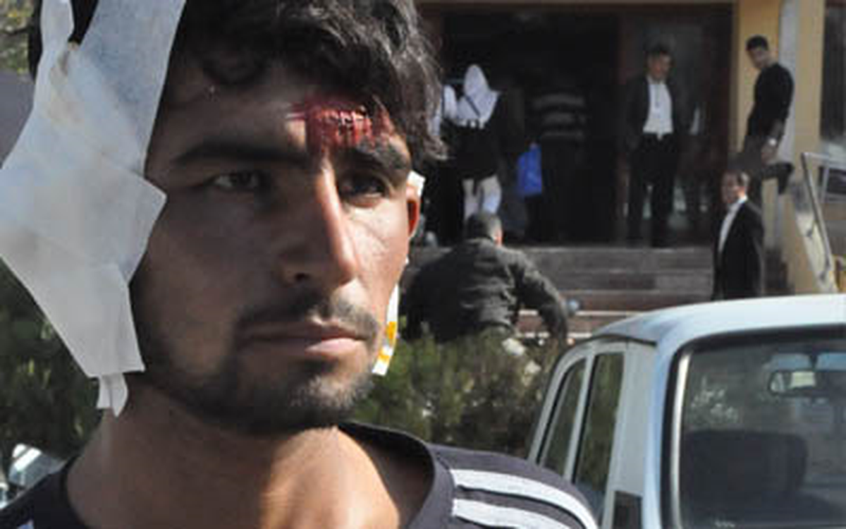 Kobani Yaralılarının Durumu İyiye Gidiyor