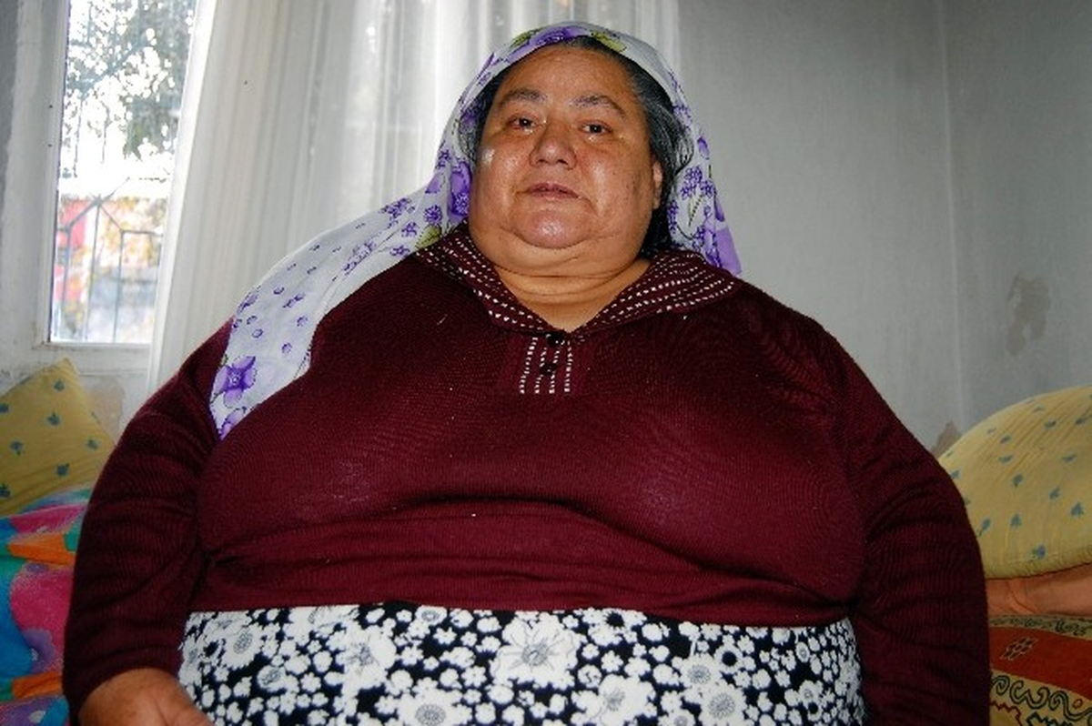 180 Kiloluk Kadın Yataktan Kalkamıyor
