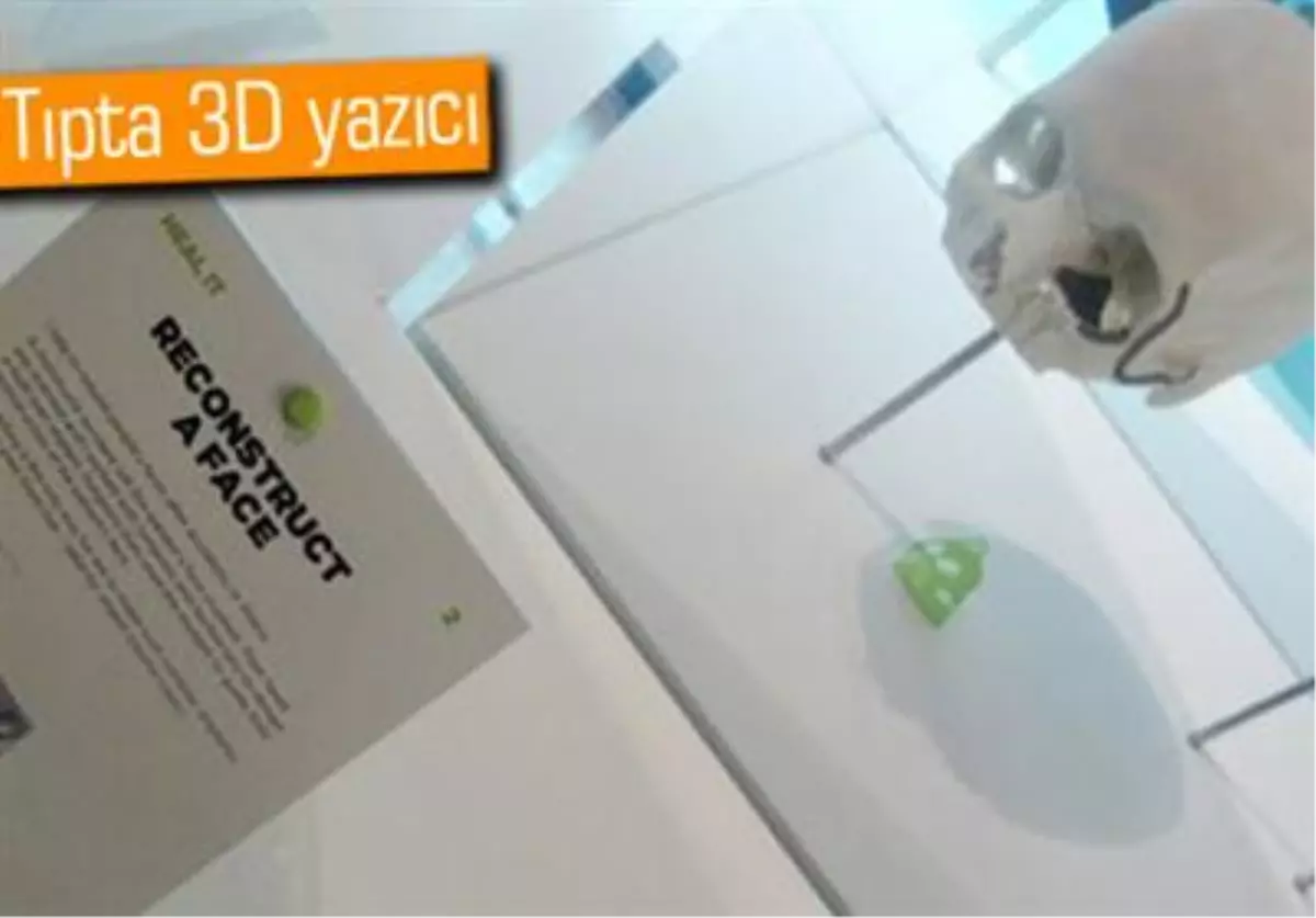 3d Yazıcı Hastanın Yüzünü Tedavi Ediyor