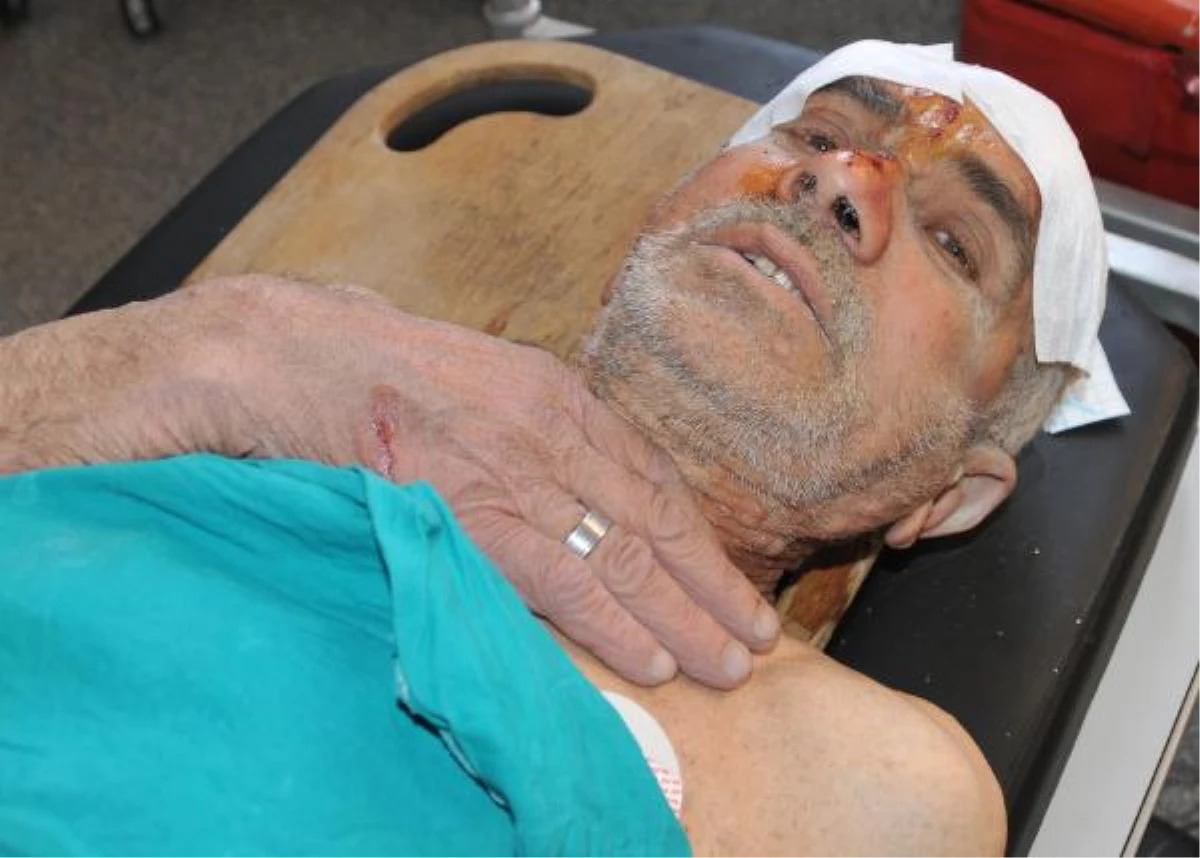 Sivas\'ta 71\'lik Adam Asansör Boşluğuna Düşerek Yaralandı