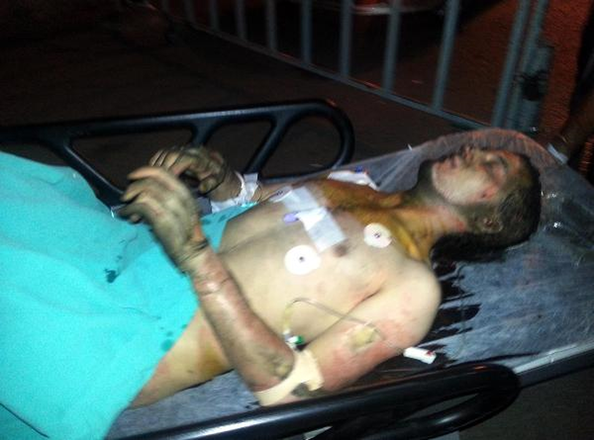 Eski Sevgilisinin Konuşmak İstemediği Genç Kendini Yaktı