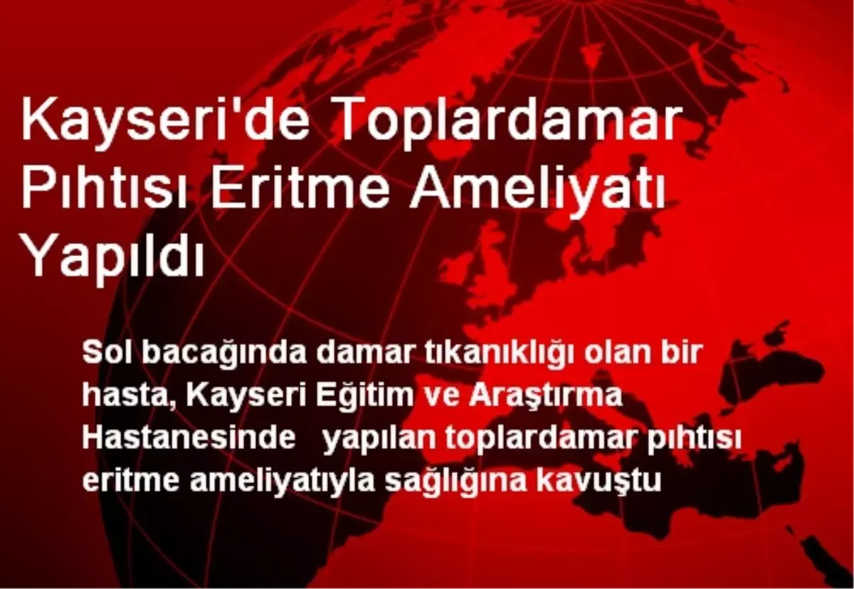 Kayseri\'de Toplardamar Pıhtısı Eritme Ameliyatı Yapıldı