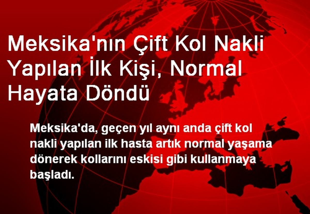 Meksika\'nın Çift Kol Nakli Yapılan İlk Kişi, Normal Hayata Döndü
