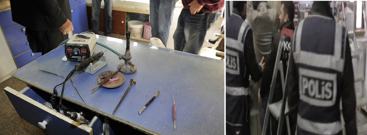 Yasadışı Diş Laboratuarları Kapandı