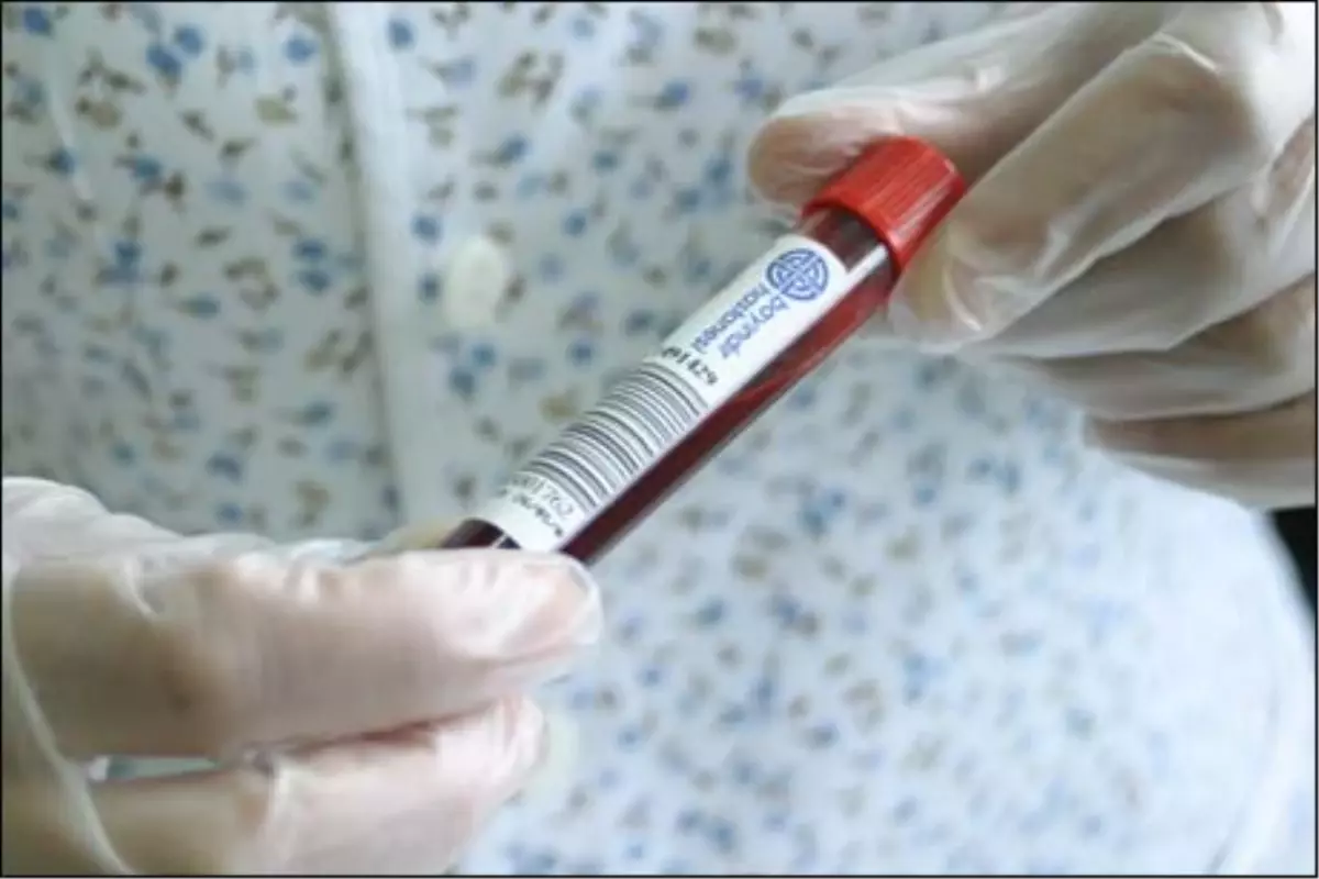 "Tarama Testleri Hem Hasta Hem de Sağlık Çalışanları Açısından Önemli"