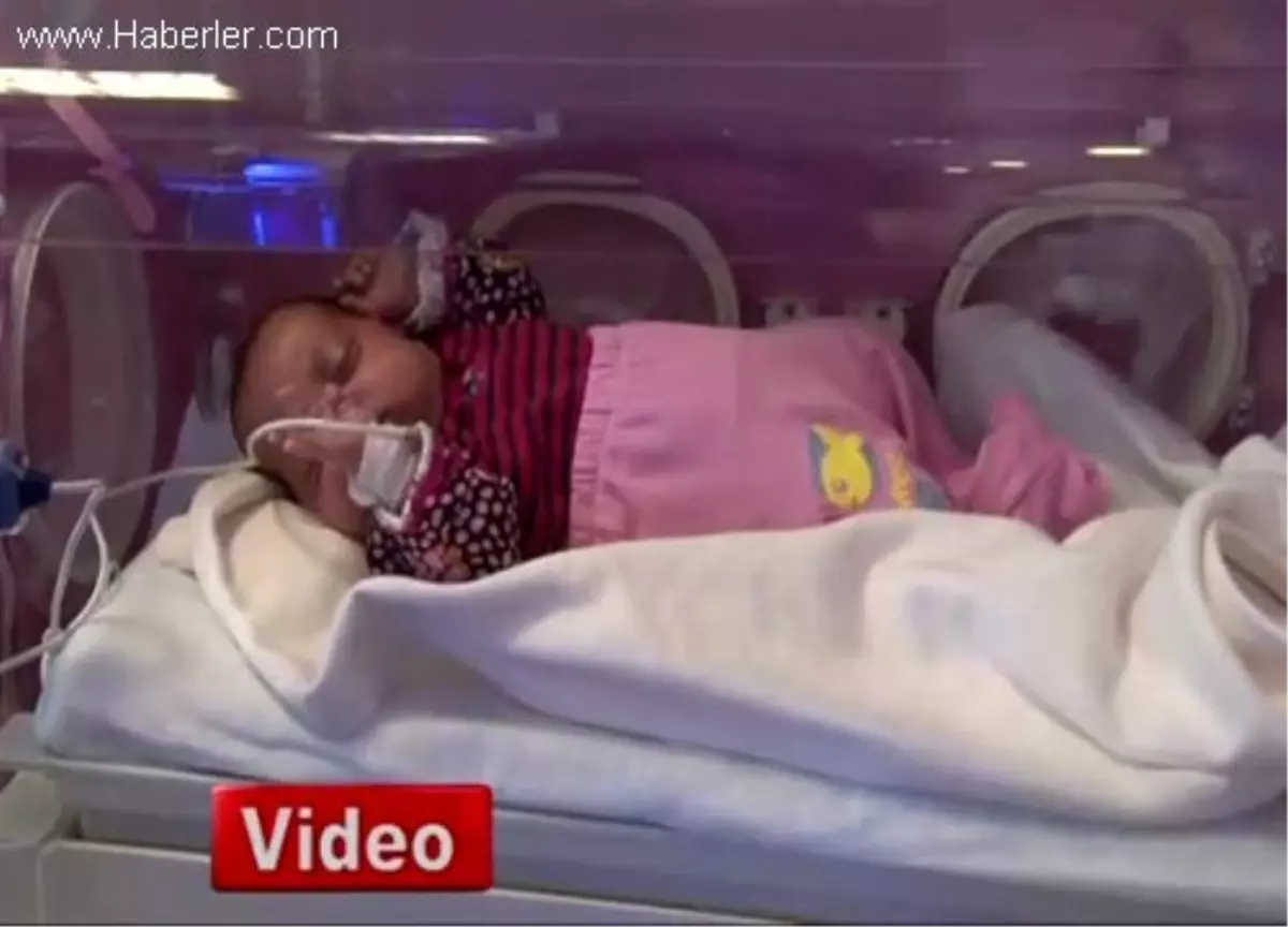 24 Haftalık Minik Hülya Hayata Tutundu