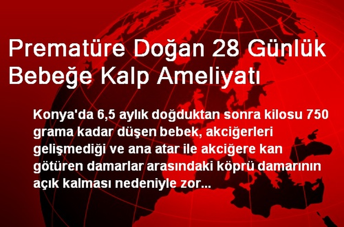 Prematüre Doğan 28 Günlük Bebeğe Kalp Ameliyatı