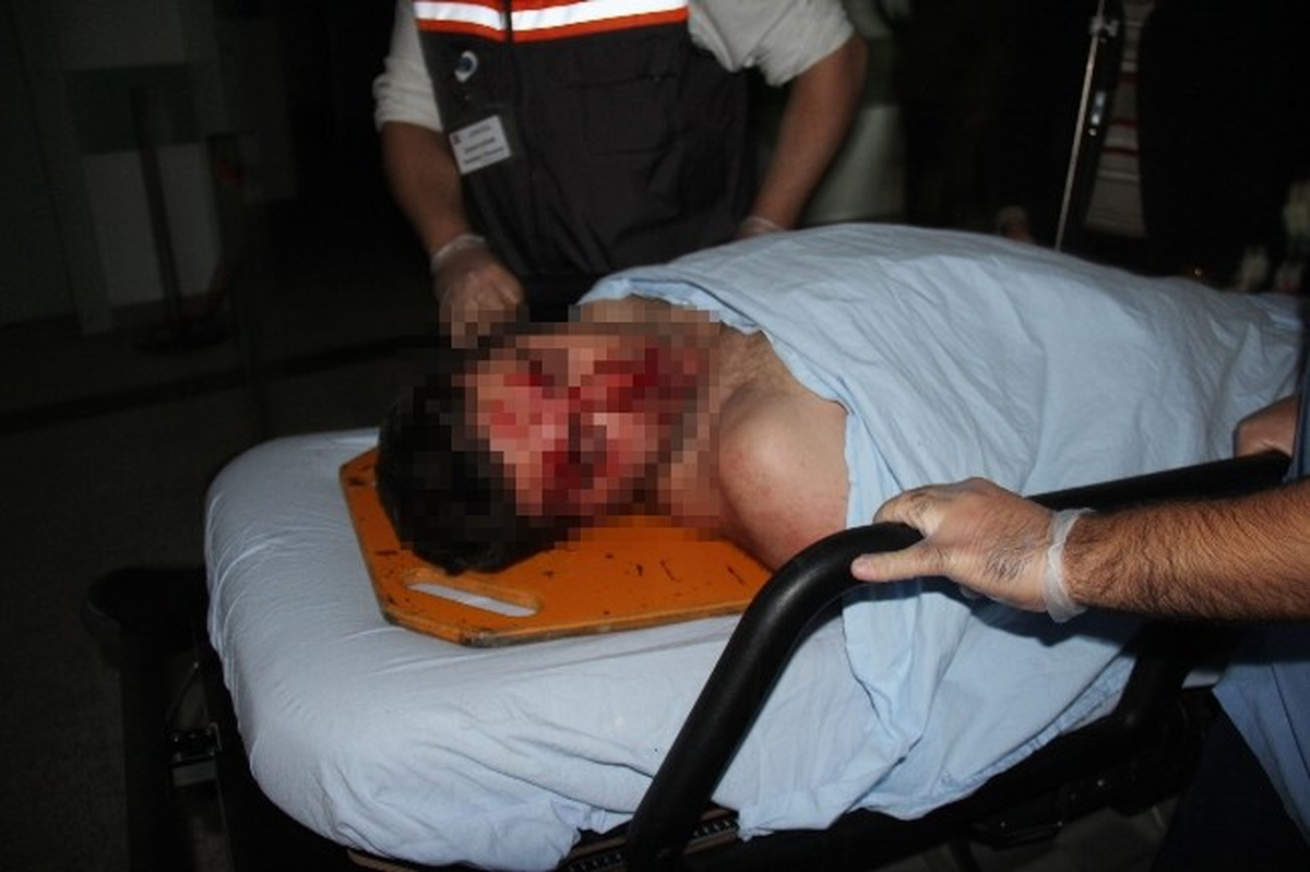 Kamyonun Çarptığı Narkotik Polisi Yaralandı