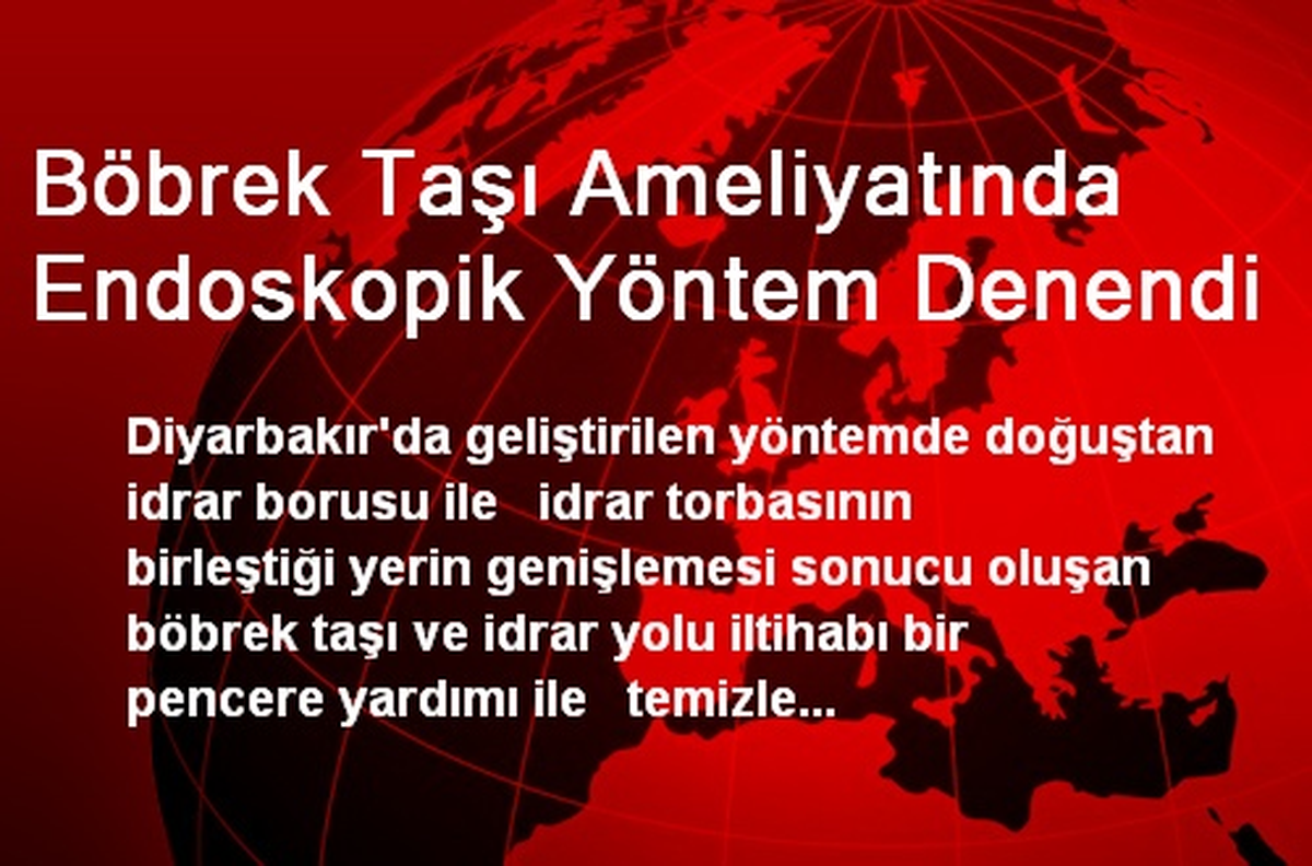 Böbrek Taşı Ameliyatında Endoskopik Yöntem Denendi
