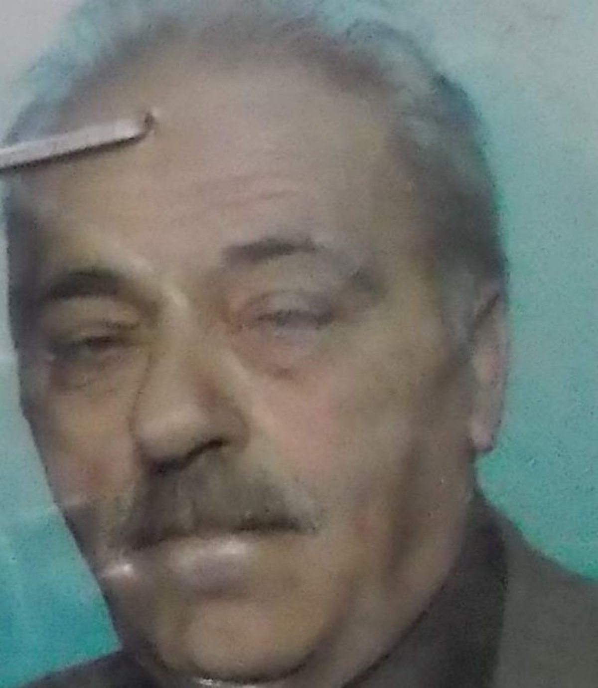 Eşinin Yanında Refakatçi Olarak Kalan Yaşlı Adam Fenalaşarak Yaşımını Yitirdi