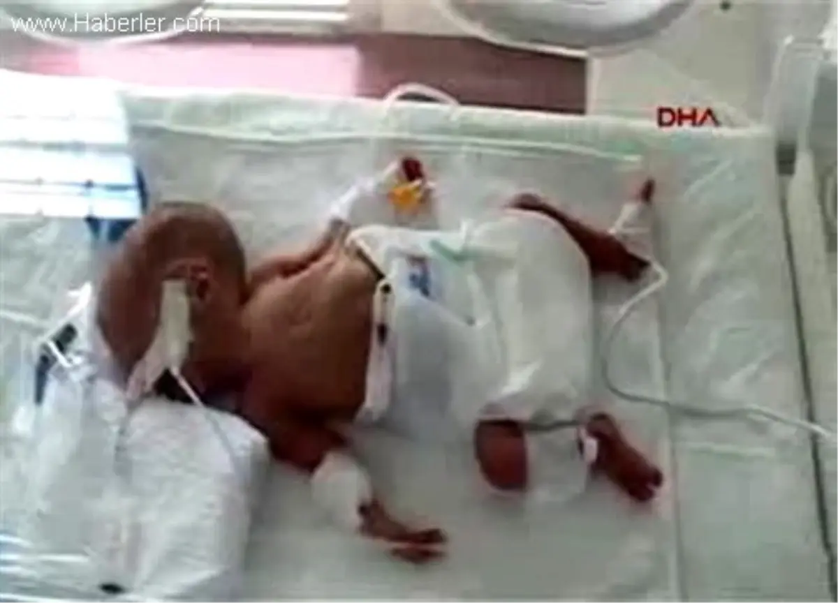 Gölhisar'da Genç Çiftin Dördüz Bebek Sevinci