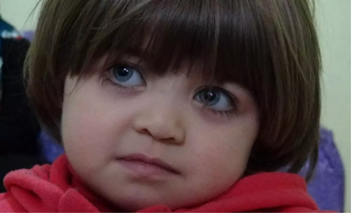 5 Yaşında Olmasına Rağmen 1.5 Yaşında Görünüyor