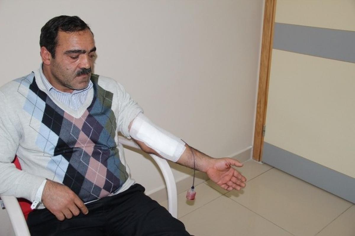 Kolunu Kaybetmekten Son Anda Kurtuldu