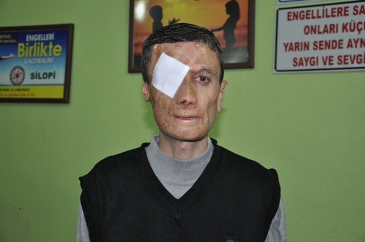 Hayırsever Avukattan Engelli Vatandaşlara Kışlık Giyim Yardımı