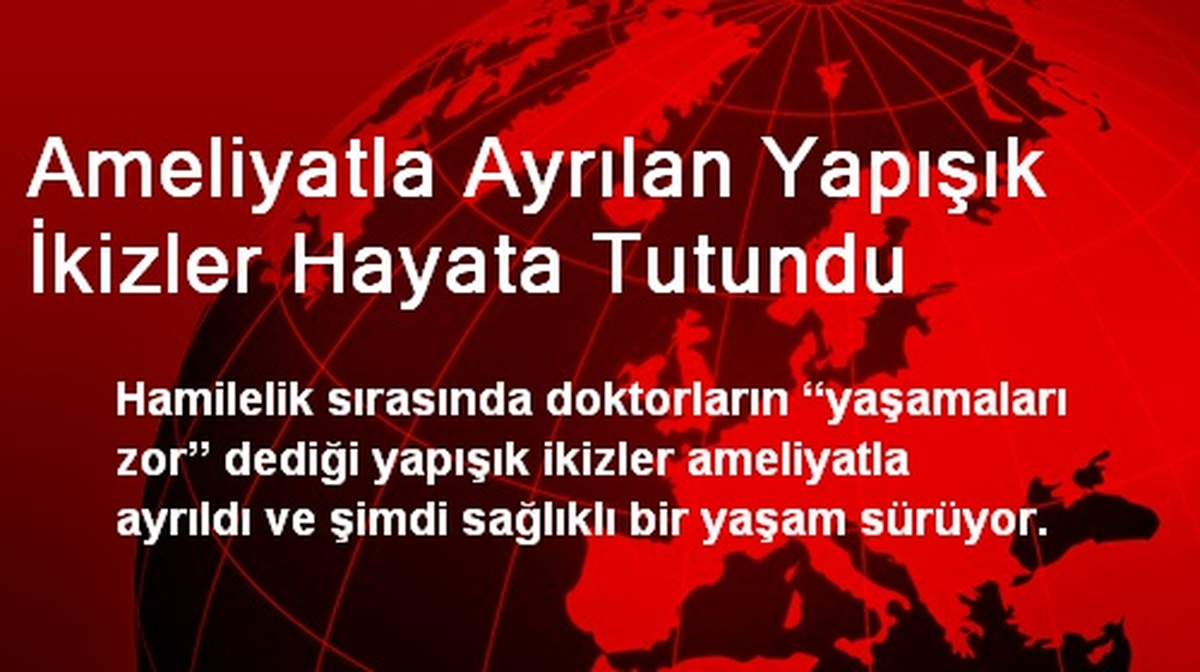 Ameliyatla Ayrılan Yapışık İkizler Hayata Tutundu