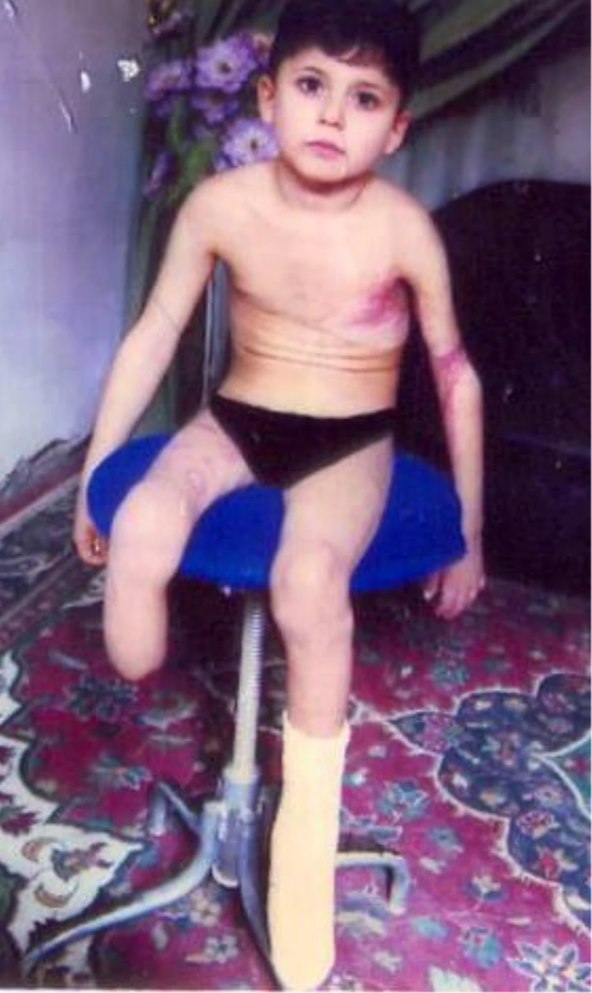 Iraklı Mustafa Muhammed\'e Engelli Aracı